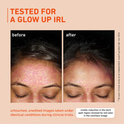 Plum 15% Vitamin C Serum for Glowing Skin | for Oily, Dry & Combination Skin | Reduce Pigmentation & Dark Spot |with Mandarin | Non-Irritating, Hydrating & Soothing | Face Serum for Men & Women | 20ml