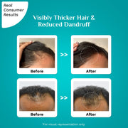 PILGRIM 3% Redensyl & 4% Anagain Advanced Hair Growth Serum For Dandruff-Prone Scalp - 30 ml Discover Thick Dense Hair, & Reduced Dandruff