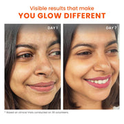 FOXTALE Overnight Glow Mask For a salon-like brightening facial overnight | 30ml