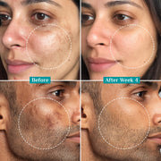 PILGRIM 15% Vitamin C Face Serum For Advanced Brightness (20 ml) With Ferulic Acid and Niacinamide