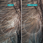 Pilgrim Australian Tea Tree Non-Drying Anti-Dandruff Shampoo 200 ml | Removes Dandruff from Source | Helps with Itching, Irritation | Strong & Smooth Hair | For Men & Women |